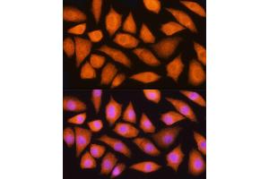 Immunofluorescence analysis of L929 cells using GMFB Rabbit pAb (ABIN6131732, ABIN6141181, ABIN6141182 and ABIN6224741) at dilution of 1:100 (40x lens).