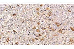 Detection of PSAP in Rat Spinal cord Tissue using Polyclonal Antibody to Prosaposin (PSAP)