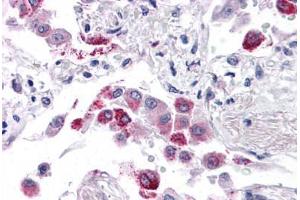 Human Lung: Formalin-Fixed, Paraffin-Embedded (FFPE) (EFHD1 anticorps  (N-Term))