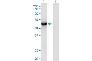 Western Blot analysis of CAMKK1 expression in transfected 293T cell line by CAMKK1 monoclonal antibody (M05), clone 3B4. (CAMKK1 anticorps  (AA 2-100))