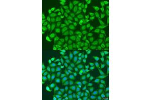 Immunofluorescence analysis of U2OS cells using PCDH antibody (ABIN6128584, ABIN6145301, ABIN6145302 and ABIN6220787) at dilution of 1:100. (PCDHA6 anticorps  (AA 1-230))