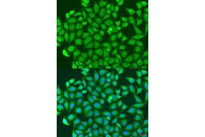 Immunofluorescence analysis of U2OS cells using PCDH antibody (ABIN6128584, ABIN6145301, ABIN6145302 and ABIN6220787) at dilution of 1:100. (PCDHA6 anticorps  (AA 1-230))