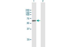 Western Blot analysis of TPBG expression in transfected 293T cell line by TPBG MaxPab polyclonal antibody. (TPBG anticorps  (AA 1-420))
