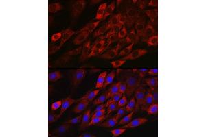 Immunofluorescence analysis of NIH/3T3 cells using TXNIP antibody (ABIN6130776, ABIN6149733, ABIN6149734 and ABIN6224986) at dilution of 1:100.