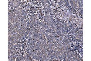 IHC analysis of Integrin Linked ILK using anti-Integrin Linked ILK antibody (ABIN7599411). (ILK anticorps  (AA 1-452))