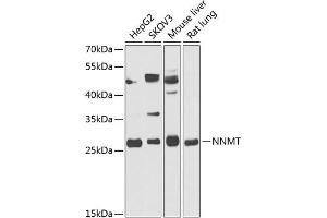 Western blot analysis of extracts of various cell lines, using NNMT antibody (ABIN6130587, ABIN6144695, ABIN6144697 and ABIN6218242) at 1:1000 dilution. (NNMT anticorps  (AA 1-264))