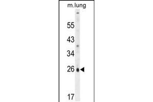 Western blot analysis in mouse lung tissue lysates (35ug/lane). (PQLC1 anticorps  (AA 100-128))