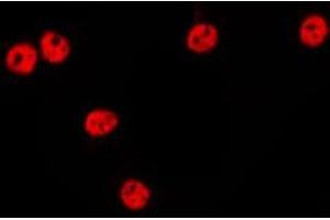 ABIN6275634 staining HepG2 by IF/ICC. (TCEAL1 anticorps  (Internal Region))