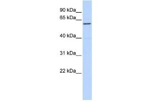 WB Suggested Anti-ZNF165 Antibody Titration:  0. (ZNF165 anticorps  (Middle Region))