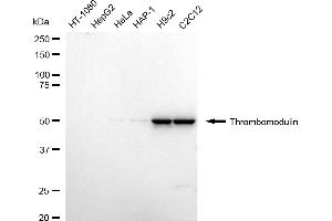 Western blotting analysis using Thrombomodulin antibody (ABIN7800548).