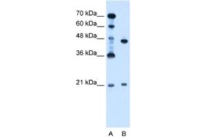 Western Blotting (WB) image for anti-Ubiquitin-Conjugating Enzyme E2E 2 (UBE2E2) antibody (ABIN2462697) (UBE2E2 anticorps)