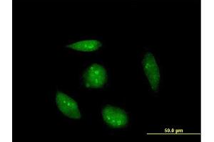 Immunofluorescence of purified MaxPab antibody to RAG2 on HeLa cell. (RAG2 anticorps  (AA 1-527))
