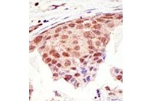 Image no. 3 for anti-Small Ubiquitin Related Modifier Protein 1 (SUMO1) (C-Term) antibody (ABIN356734)