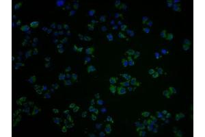 Immunofluorescence staining of Hela cells with ABIN7139953 at 1:100, counter-stained with DAPI. (OR1A2 anticorps  (AA 247-262))
