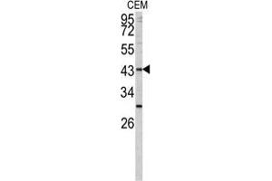 Western blot analysis of FUT1 antibody (Center) in CEM cell line lysates (35 µg/lane).