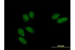 Immunofluorescence of purified MaxPab antibody to SSU72 on HeLa cell. (SSU72 anticorps  (AA 1-194))