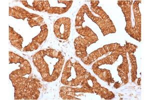 Formalin-fixed, paraffin-embedded human Prostate tissue stained with Annexin A1 Mouse Monoclonal Antibody (ANXA1/1671).
