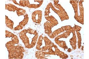 Formalin-fixed, paraffin-embedded human Prostate tissue stained with Annexin A1 Mouse Monoclonal Antibody (ANXA1/1671). (Annexin a1 anticorps)