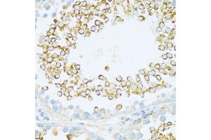 Immunohistochemistry of paraffin-embedded rat testis using DVL1 antibody (ABIN7266796) at dilution of 1:100 (40x lens).
