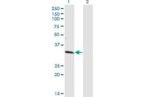 Western Blot analysis of ZNF101 expression in transfected 293T cell line by ZNF101 monoclonal antibody (M01), clone 2D5.