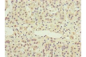 anti-Protein Phosphatase 2A 48 KDa Regulatory Subunit (PPP2R3B) (AA 356-575), (Regulatory Subunit B) antibody