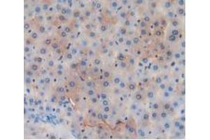 Figure. (GSTA4 anticorps  (AA 2-222))