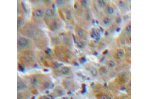 Used in DAB staining on fromalin fixed paraffin-embedded Liver tissue (MBL2 anticorps  (AA 42-96))