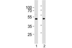 Western blot analysis of lysate from 1) human brain and 2) mouse brain tissue lysate using PRMT8 antibody at 1:1000. (PRMT8 anticorps  (AA 344-373))