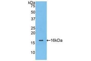 Detection of Recombinant FABP4, Mouse using Polyclonal Antibody to Fatty Acid Binding Protein 4 (FABP4) (FABP4 anticorps  (AA 2-132))