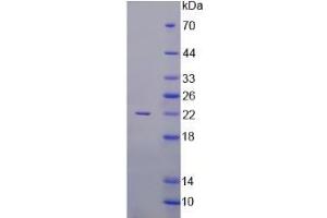 Image no. 1 for Activin A (ACVA) (AA 44-178) protein (His tag) (ABIN3209855) (ACVA Protein (AA 44-178) (His tag))