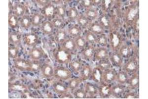 IHC-P analysis of Rat Kidney Tissue, with DAB staining. (CAMK2A anticorps  (AA 1-478))