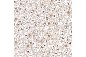 Immunohistochemistry of paraffin-embedded mouse liver using [KO Validated] PRMT4/C Rabbit pAb (ABIN1682307, ABIN3015886, ABIN3015887 and ABIN6219468) at dilution of 1:25 (40x lens). (CARM1 anticorps  (AA 409-608))
