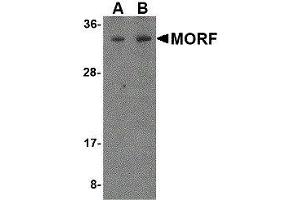 Western Blotting (WB) image for anti-Mortality Factor 4 (MORF4) antibody (ABIN2475740)