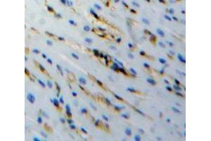 Used in DAB staining on fromalin fixed paraffin-embedded stomach tissue