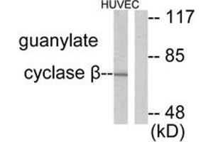 Western blot analysis of extracts from HuvEc cells, using Guanylate Cyclase beta Antibody. (GUCYB anticorps  (AA 10-59))