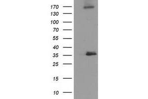 Western Blotting (WB) image for anti-Nudix (Nucleoside Diphosphate Linked Moiety X)-Type Motif 6 (NUDT6) antibody (ABIN1499864) (NUDT6 anticorps)