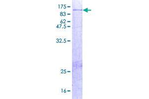 Image no. 1 for Amine Oxidase, Copper Containing 2 (Retina-Specific) (AOC2) (AA 1-756) protein (GST tag) (ABIN1345215)