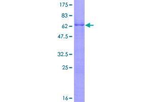 Image no. 1 for PHD Finger Protein 6 (PHF6) (AA 1-312) protein (GST tag) (ABIN1314902)