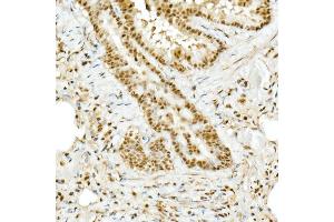 Immunohistochemistry of paraffin-embedded rat lung using TOPBP1 Rabbit pAb (ABIN6129493, ABIN6149398, ABIN6149401 and ABIN6221465) at dilution of 1:50 (40x lens). (TOPBP1 anticorps  (AA 1253-1522))