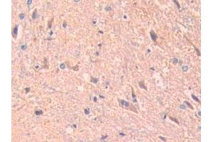 IHC-P analysis of Rat Spinal cord Tissue, with DAB staining. (ADAM10 anticorps  (AA 218-445))