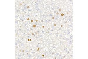 Immunohistochemistry of paraffin-embedded mouse liver using [KO Validated] CDKN1A/p21CIP1 Rabbit mAb (ABIN7266599) at dilution of 1:100 (40x lens). (p21 anticorps)