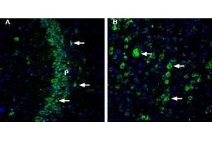 Expression of CHERP in mouse brain - Immunohistochemical staining of mouse brain sections using Anti-CHERP Antibody (ABIN7043011, ABIN7044119 and ABIN7044120).