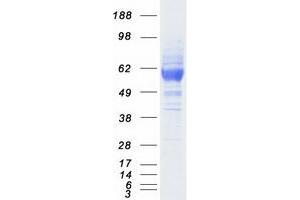 Validation with Western Blot