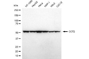 anti-Chaperonin Containing TCP1, Subunit 6A (Zeta 1) (CCT6A) (Subunit 2) antibody