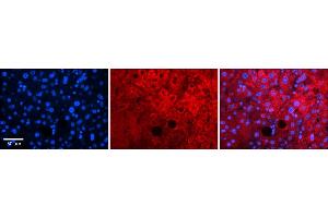 Rabbit Anti-Pard6b Antibody    Formalin Fixed Paraffin Embedded Tissue: Human Adult liver  Observed Staining: Cytoplasmic,Membrane Primary Antibody Concentration: 1:600 Secondary Antibody: Donkey anti-Rabbit-Cy2/3 Secondary Antibody Concentration: 1:200 Magnification: 20X Exposure Time: 0. (PARD6B anticorps  (N-Term))
