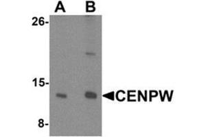 Western blot analysis of CENPW in HeLa cell lysate lysate with CENPW Antibody  at (A) 0. (CENPW anticorps  (N-Term))