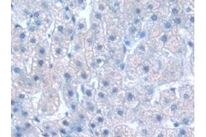 Detection of GbL in Human Liver Tissue using Polyclonal Antibody to G Protein Beta Subunit Like Protein (GbL)