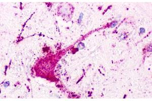 anti-Purinergic Receptor P2Y, G-Protein Coupled, 1 (P2RY1) (Extracellular Domain) antibody