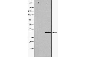 Western blot analysis of extracts of hela , using CDK4 antibody.