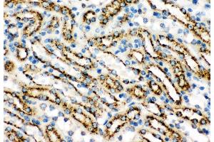 Anti-Cathepsin D Picoband antibody,  IHC(P): Mouse Kidney Tissue (Cathepsin D anticorps  (AA 65-410))